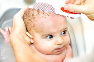 Ciemieniucha u niemowlaka - najważniejsze informacje, przyczyny, leczenie
